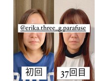 スリージー/before／after