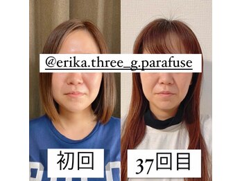 スリージー/before/after