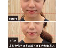 良久庵鍼灸接骨院の雰囲気（美容鍼×ヒト幹細胞導入で極上の肌メンテナンス）