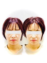 ワカヤマ 小顔(Wakayama)/★Before・After★