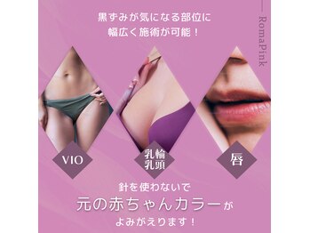 ラディアント(RADIANT)