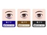 目のたるみ！クマでお悩みの方にオプションクーポン¥2000