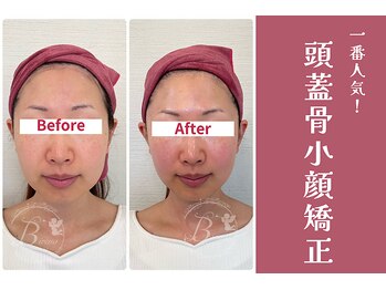 ビレナ 守谷店(Birena)/Birena式頭蓋骨小顔矯正