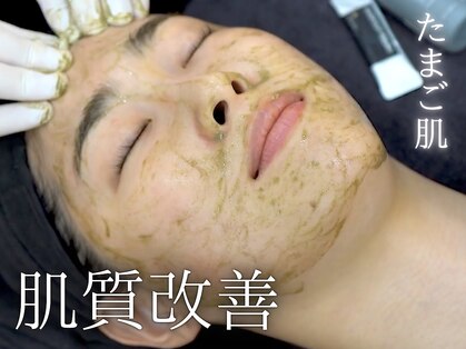 ヴィータドラータ(Vita dorata)の写真