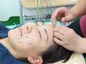 【理想のお肌へ】気になる肌トラブルに効果◎美容鍼 ¥4400