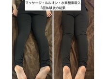 ヨサパーク ライズ 大日(YOSA PARK RISE)/BeforeAfter