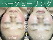 モア 多治見店(MORE)/お客様ビフォーアフター♪