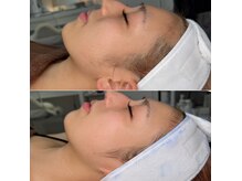 サロン キュー(Salon Cue)の雰囲気(【デザインWAX】低刺激WAXでつるっとむき卵★トーンアップ効果◎)