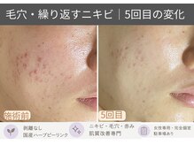 おうちサロン ミキ