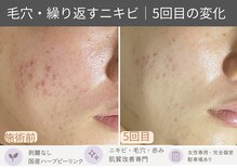 おうちサロン ミキ