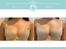 美人バスト 赤羽店/【バストアップ★育乳】症例