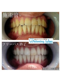 シフォン 豊田店/3週間フリーパス終了のお客様