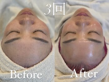 ザ パールズ(The Pearls)/３回でこの艶感♪