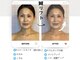 ハリアン 麻布十番(Halian)の写真