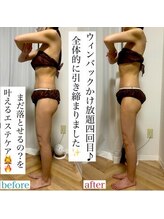 アモ(amo.)/もう少し落としたい！も叶います