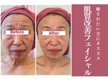 ビレナ 守谷店(Birena)/癒されたい方に!