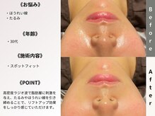 ルディラ 上野店/スポットフィット