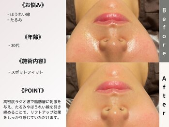 ルディラ 上野店/スポットフィット