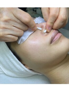 スロー(Slow)/【フェイシャル】毛穴解消!