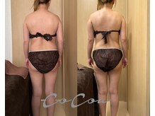 マイティー整骨院 ココア(CoCoa)の雰囲気（新感覚！吸われてスッキリ♪活性リンパ洗浄！お得なクーポンあり）