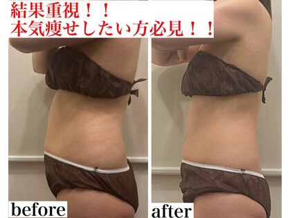 ルポ(Repos)の写真