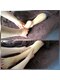 サーノヴィーター(Sano Vita)の写真/深部筋肉緊張と指関節を改善◎膝裏リンパ節と筋肉の起始部を同時アプローチで靴を履いた時の驚きと感動