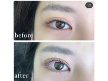 ゆくい/立ち上げラッシュリフト