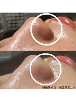 ファウンデーション(FOUNDATION)/最強の組み合わせ!