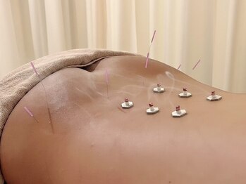 茶ノ木鍼灸整骨院/