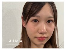 アイマ(AIMA)/アップリフティング