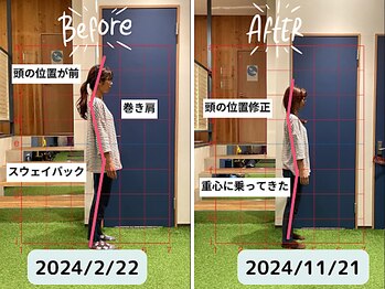 ファクト(fact)/20年以上の頭痛が改善!