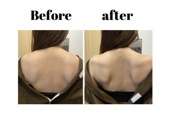 リモド(Rimodo509)/肩甲骨はがし(リンパマッサージ