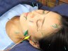 【人気No .1】【5回目以降】電気リフトアップ美容鍼＋ドライヘッドスパ45分