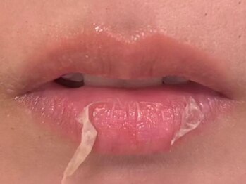 ビューティーリバース 新横浜店の写真/＼韓国で大人気／ローマピンク導入！1回施術で効果実感！赤ちゃんピンクへ