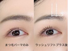 ラニ(Lani)/ラッシュリフトプラス