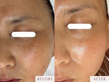 クラームビューティー(Clerm beauty)/【40代 女性】幹細胞プログラム