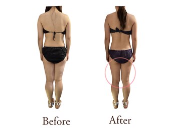 アダム(Adam)/後姿の印象変化