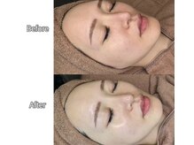 レミーラ(Remira)の雰囲気(★正規代理店【ララピール】人気No. 1の肌育メニュー)