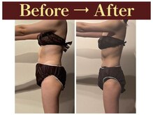 グレースフルタイム プレミアム(Graceful Time PREMIUM)/ビフォーアフター