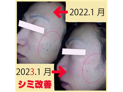 ベティ アンド ボーテの写真