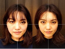 きらめき ワンライフ 川口(One Life)/小顔矯正BeforeAfter１