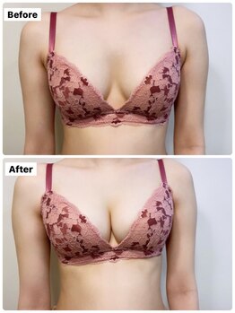 アンシャンテ(ENCHANTER)/光バストアップ