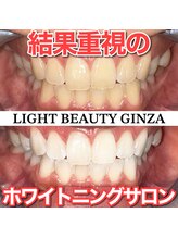 ライトビューティー 銀座店(LightBeauty)/東銀座 ホワイトニング 症例写真