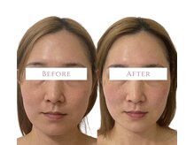 ソナ 大和西大寺院(SONA)/