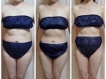 ヨサパーク リュミエール 三鷹(YOSA PARK Lumiere)/ビフォーアフター１