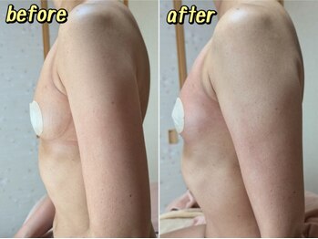 スノードロップ(snowdrop)/