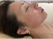 マホロバ(mahoroba)/赤みが出る人はこれくらいに