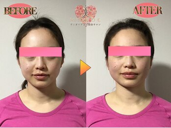 ヴィオーデ 弘前店/小顔、リンパ、ヘッドスパ、整体