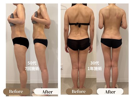 アムール(Amour)の写真