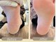 エコモマイ(e Komo mai)の写真/【フットジェルも同時施術可能！】かかとのガサガサを本格角質処理で赤ちゃんのようなツルツル艶々素足へ♪
